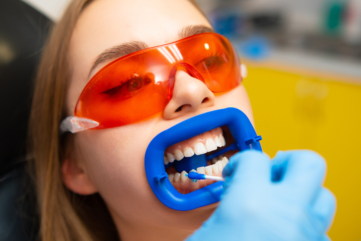 Teeth Whitening In Denver