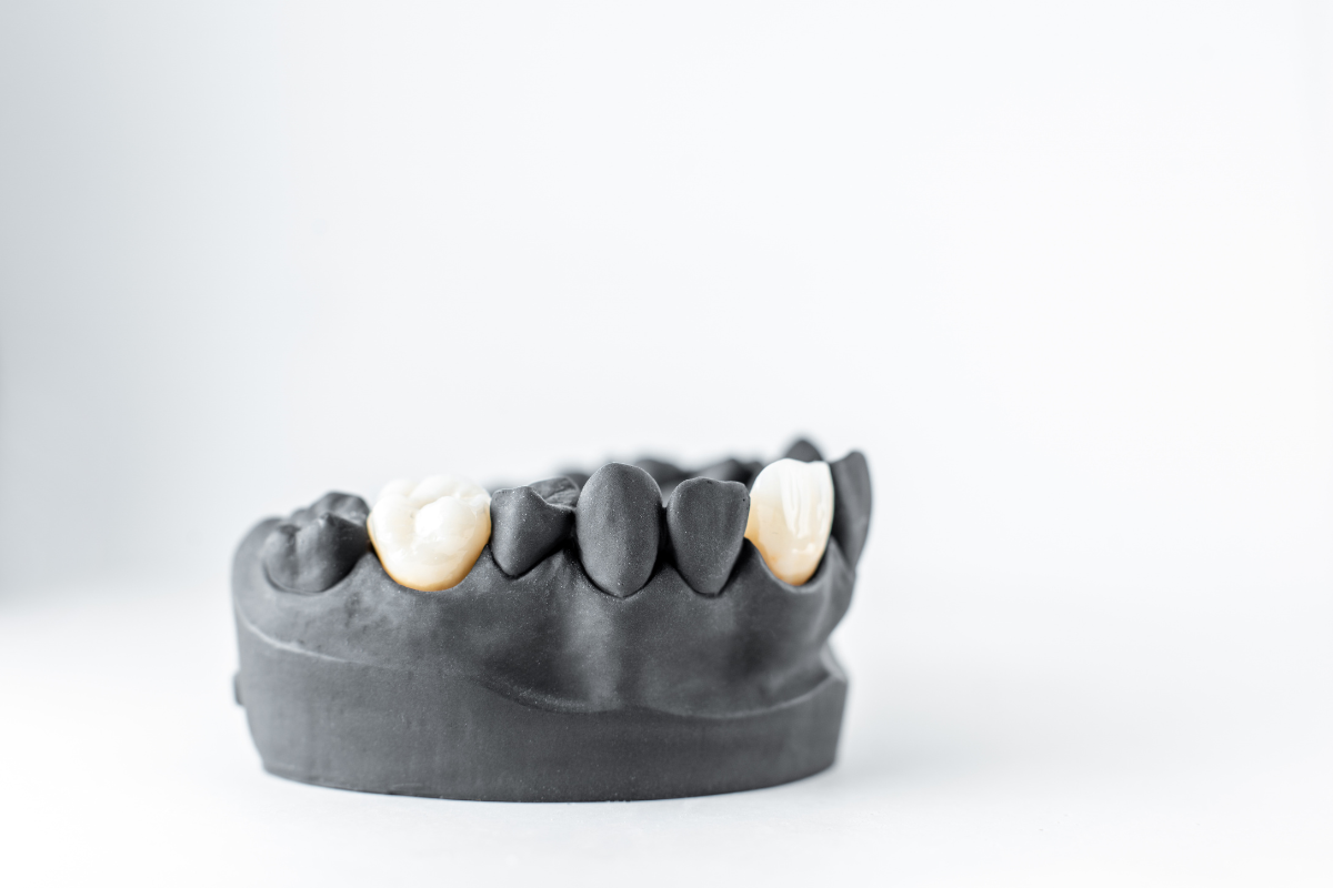 dental crowns